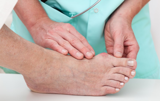 bunion surgery treatment in atlanta